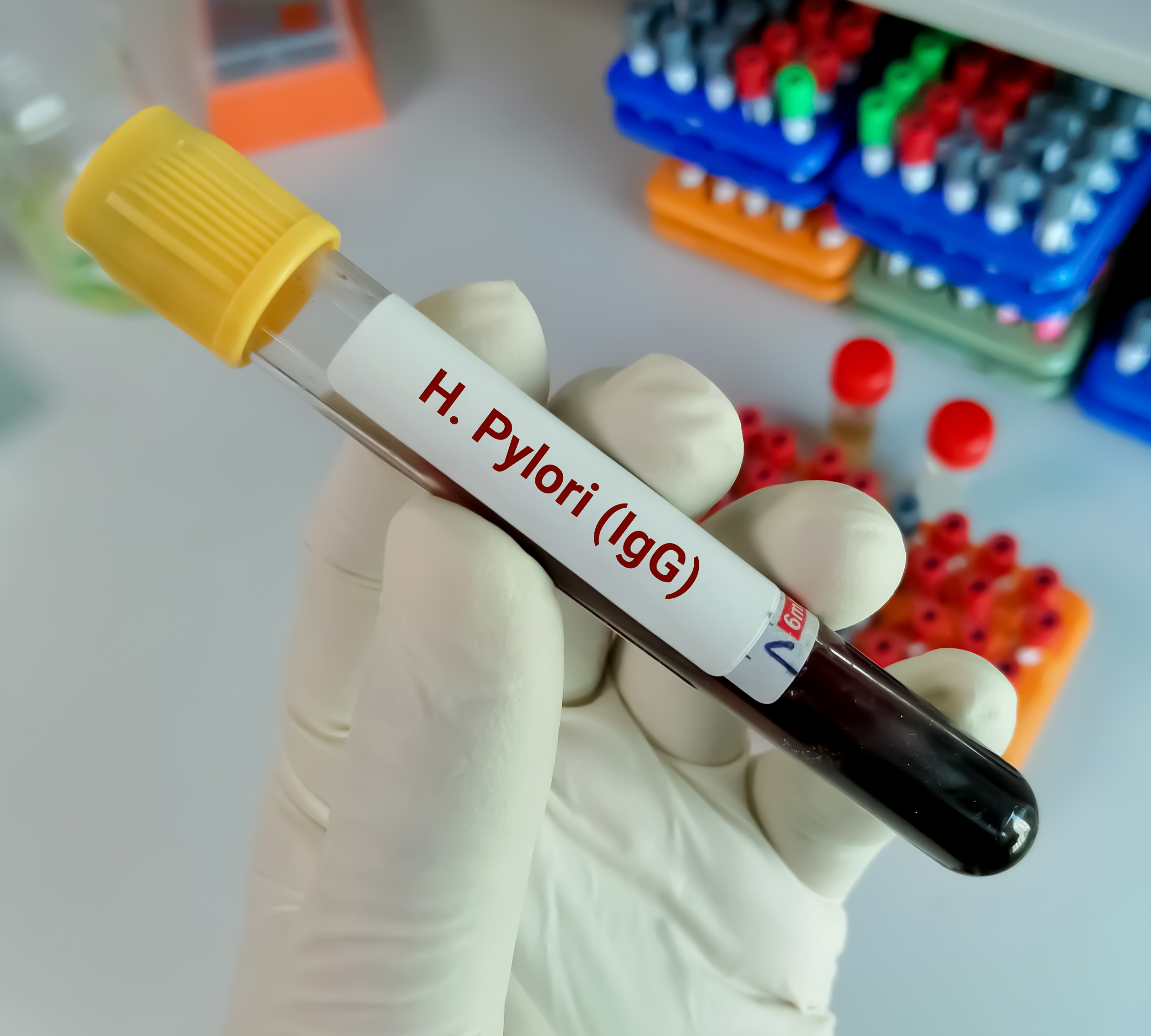 h. pylori test at home